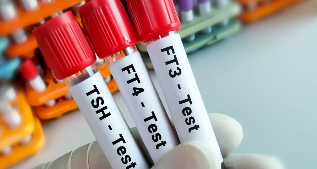 Greenville SC Thyroid Clinic Answers – Is A TSH Test Enough