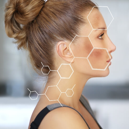 Hyperpigmentation Treatment in Greenville, SC​